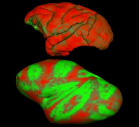 Die Faltung der Großhirnrinde beeinflusst nachhaltig die weitere Gehirnarchitektur: Aufgefaltete Regionen sind dicker (rot) als die Furchen der Hirnrinde (dünner, in grün), die erst bei einer simulierten "Entfaltung" des Großhirns (Abb. unten) sichtbar werden. Diese Dickenunterschiede werden vermutlich durch mechanische Kräfte während der Entwicklung des Gehirns verursacht.